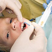 Young child receiving fluroide treatment