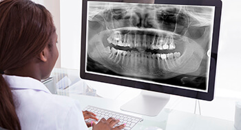 Dentist examines digital x-rays on computer