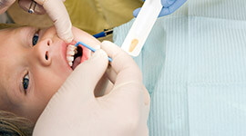 Young girl receiving fluoride treament