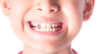 A little boy with missing teeth