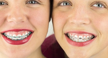 teens with braces