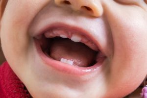 Close-up of view of baby teeth